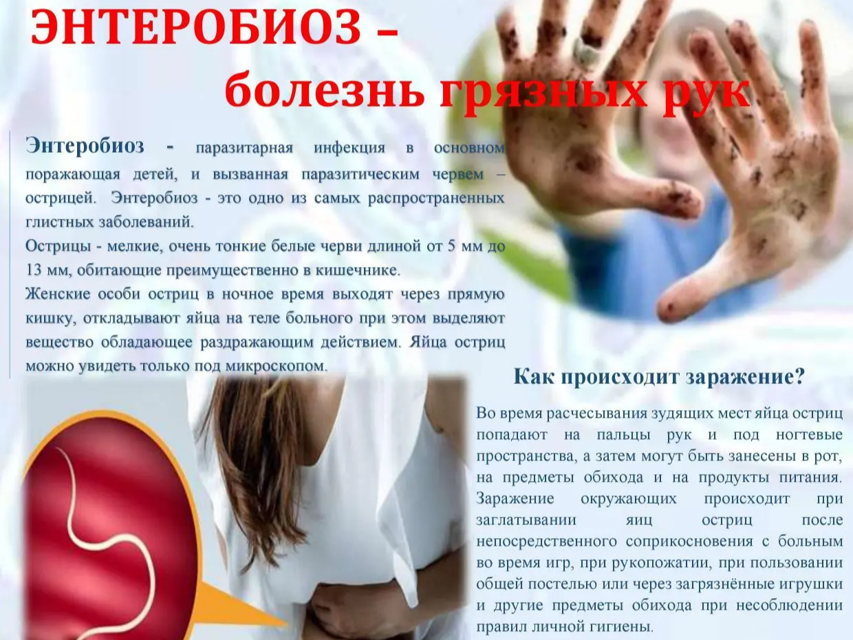 Энтеробиоз — это самое распространенное паразитарное заболевание (гельминтоз), вызываемое острицами — мелкими круглыми червями.